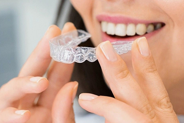 A woman is holding a clear aligner near her mouth.