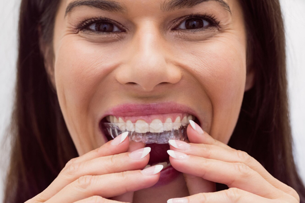 A woman is wearing clear plastic braces.