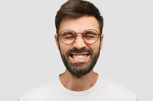 A man with a beard and glasses is making a funny face, showcasing his Crossbite.