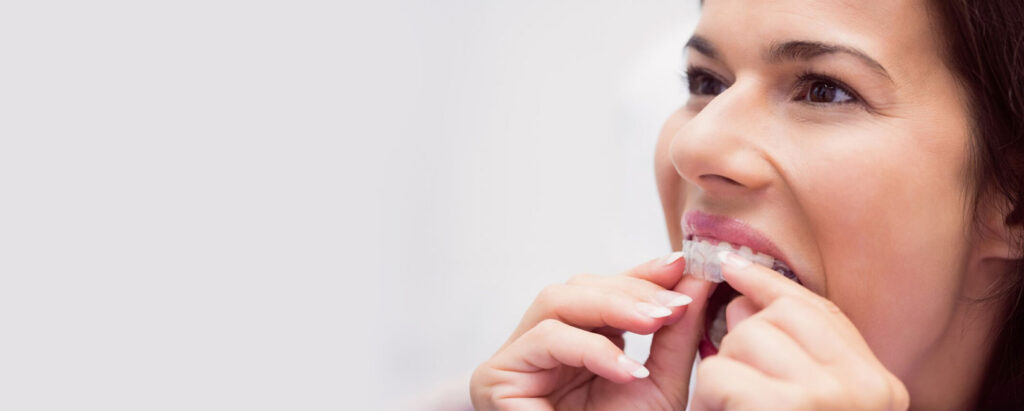 A woman is wearing invisible braces as a convenient solution for teeth straightening.