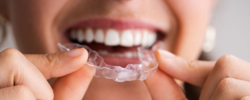 A woman is holding a clear aligner braces in her hands.