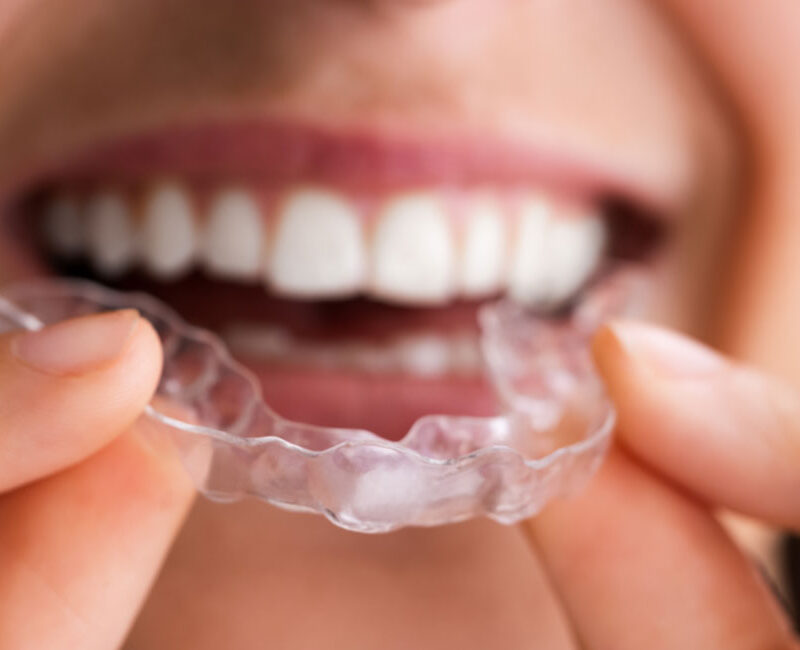 A woman is holding a clear aligner braces in her hands.