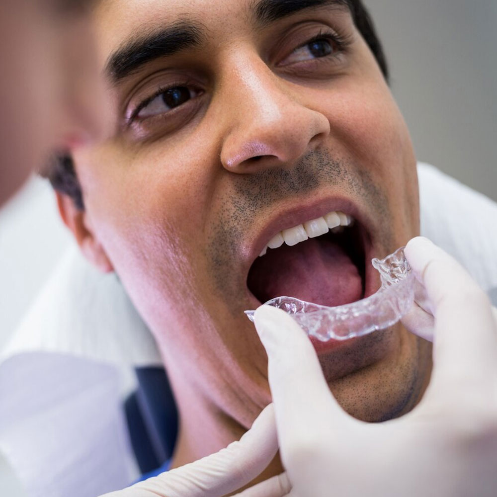 A dentist is fitting a clear aligner brace into a man’s mouth.