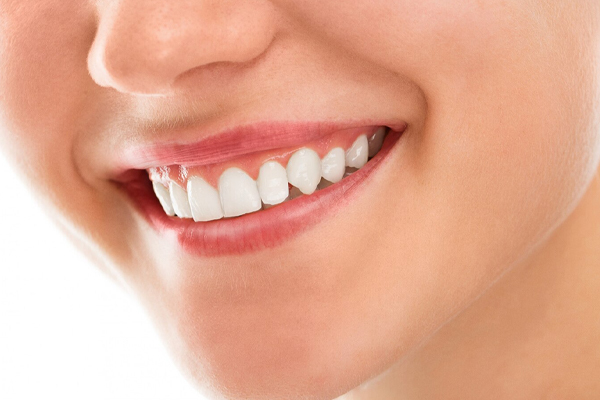 A close up of a woman's smile with white teeth.
