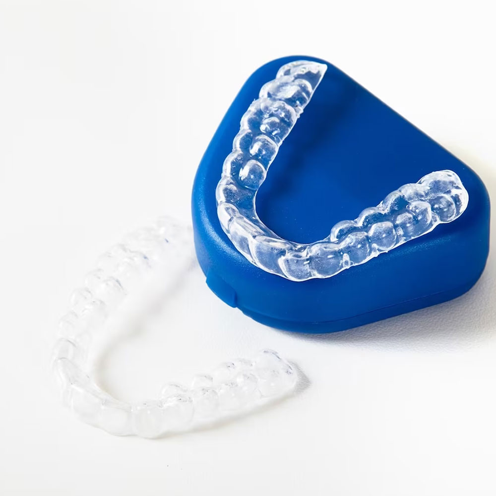 What are clear aligners
