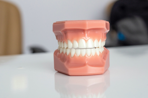 A model of a tooth sitting on a table in an office, illustrating symptoms of deep bite teeth.