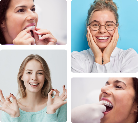 four woman collage of clear aligners