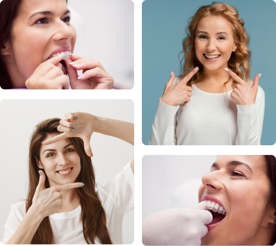 Four pictures of a woman proudly showing her straightened teeth.