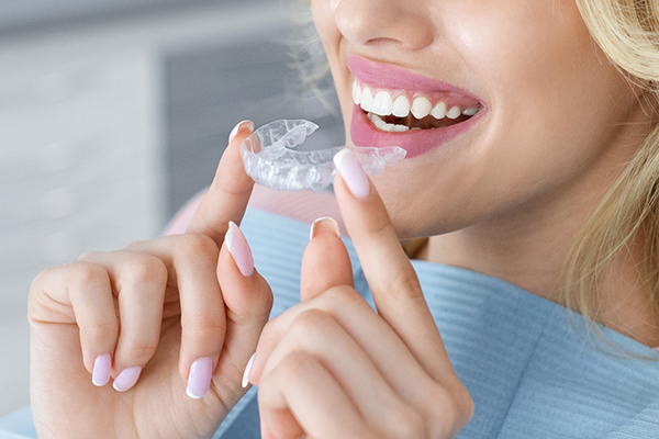 Avoid These Common Pitfalls When Using Clear Aligners